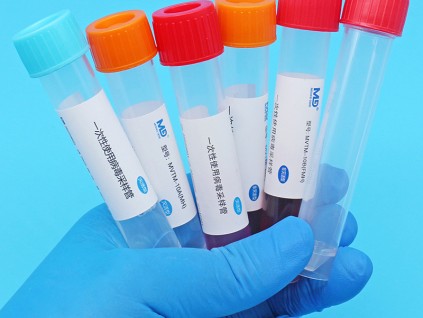 為什么推薦選擇美迪科滅活型 非滅活型一次性使用病毒采樣管？